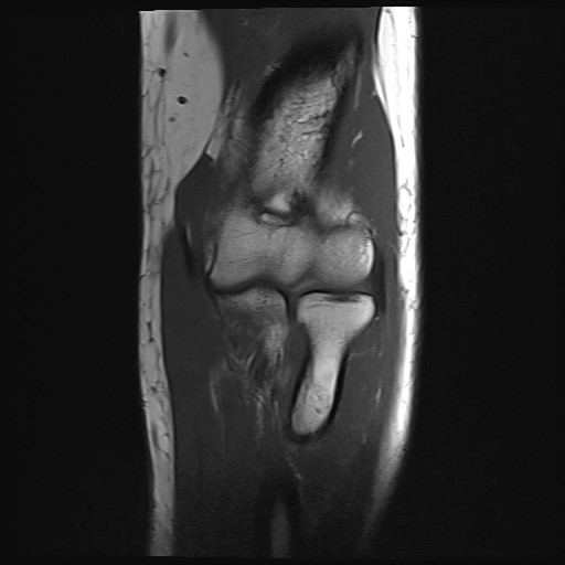 Click on the Serie image to view the images of Wieszt, Gnter